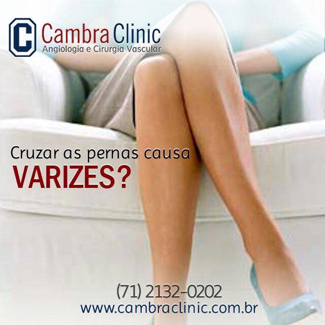 Cruzar as pernas causa Varizes