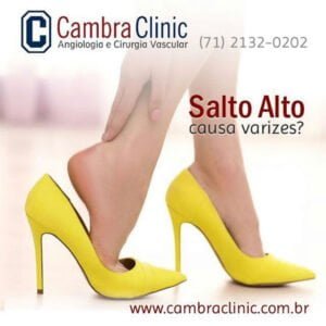 salto alto causa varizes