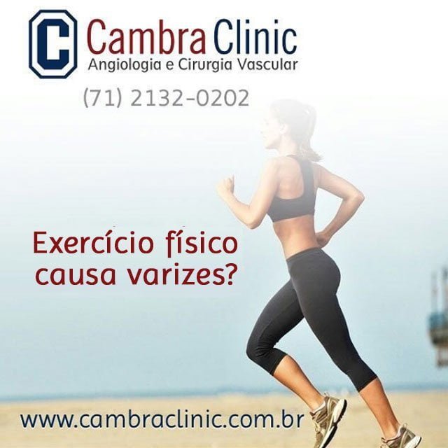 Exercício Físico causa varizes