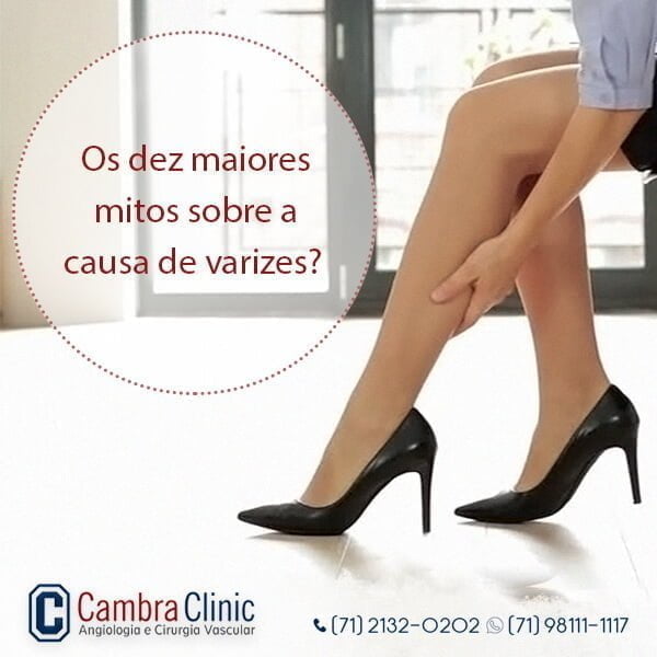 causa de varizes